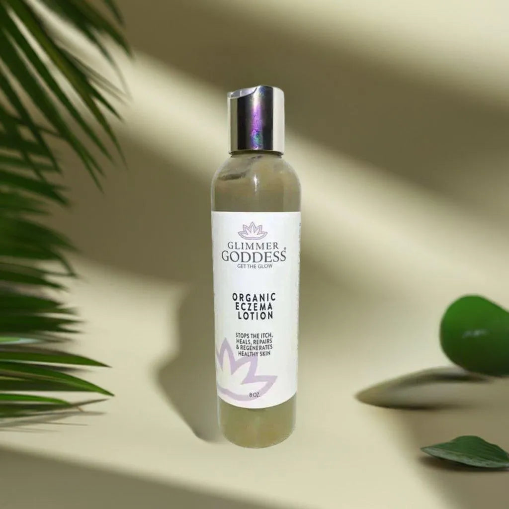 ORGANIC ECZEMA LOTION - STOP THE ITCH, HEAL THE SKIN - Beauty & Skincare, Cream, Eczema, Itch-relief, Lotion, natural, Organic , MayasBeautyPalace , www.mayasbeautypalace.com , Beauty & Skincare
