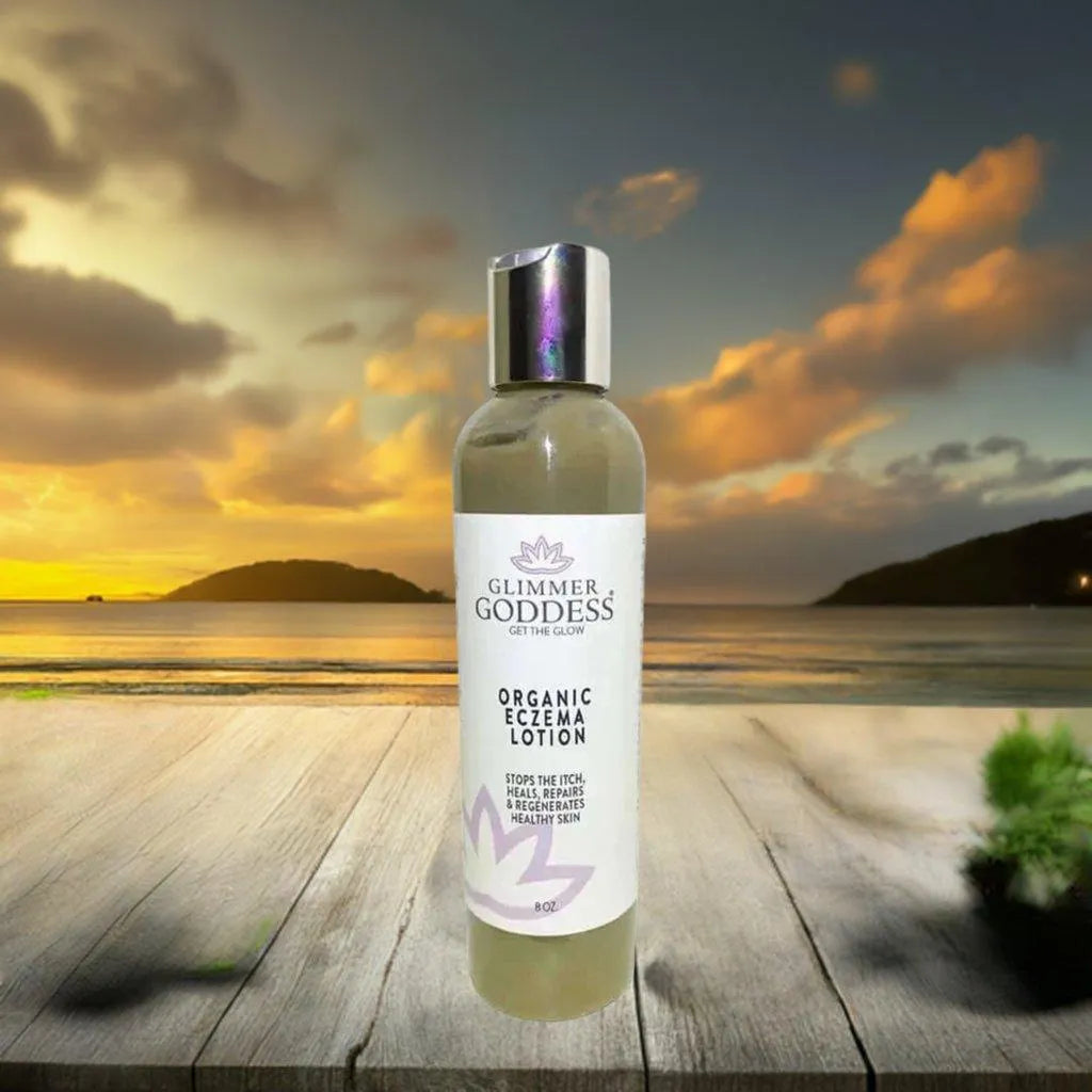 ORGANIC ECZEMA LOTION - STOP THE ITCH, HEAL THE SKIN - Beauty & Skincare, Cream, Eczema, Itch-relief, Lotion, natural, Organic , MayasBeautyPalace , www.mayasbeautypalace.com , Beauty & Skincare